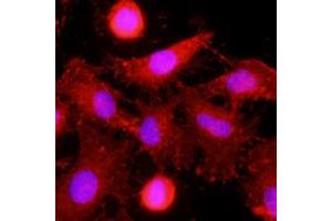 Immunofluorescence of human HeLa cells stained with monoclonal anti-human MINCLE antibody (1:500) with Texas Red (Red). (CLEC4E anticorps)