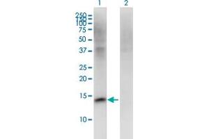 Western Blot analysis of FMN2 expression in transfected 293T cell line by FMN2 monoclonal antibody (M06), clone 1C2. (Formin 2 anticorps  (AA 144-243))
