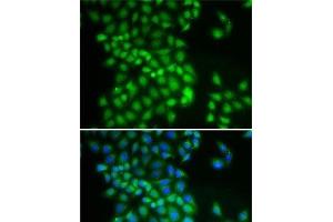 Immunofluorescence analysis of A-549 cells using YTHDC1 Polyclonal Antibody (YTHDC1 anticorps)