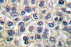 Image no. 1 for anti-Junction Plakoglobin (JUP) antibody (ABIN265337) (JUP anticorps)