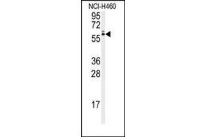 Image no. 1 for anti-Runt-Related Transcription Factor 2 (RUNX2) (Ser6533) antibody (ABIN360019) (RUNX2 anticorps  (Ser6533))