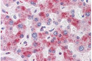 Human Liver: Formalin-Fixed, Paraffin-Embedded (FFPE)