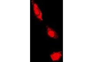 Immunofluorescent analysis of PKC iota/zeta staining in HeLa cells. (PKC iota/zeta anticorps)
