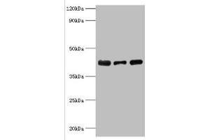 Western blot All lanes: Alpha-2, 8-sialyltransferase 8B antibody at 8 μg/mL Lane 1: Mouse heart tissue Lane 2: HepG2 whole cell lysate Lane 3: Mouse kidney tissue Secondary Goat polyclonal to rabbit IgG at 1/10000 dilution Predicted band size: 42 kDa Observed band size: 42 kDa (ST8SIA2 anticorps  (AA 24-160))