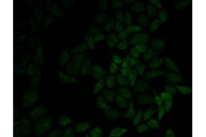 Immunofluorescence analysis of HeLa cell using MSN antibody. (Moesin anticorps)