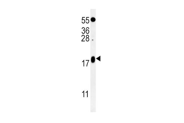 VAMP4 Antikörper  (AA 16-45)