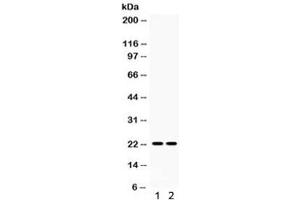 Western blot testing of 1) rat spleen and 2) rat lung lysate with Lipocalin 2 antibody. (Lipocalin 2 anticorps  (AA 21-200))
