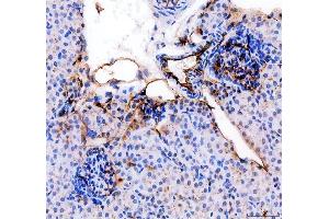 IHC analysis of CD31/Pecam1 using anti-CD31/Pecam1 antibody (ABIN7601662). (CD31 anticorps  (AA 41-258))
