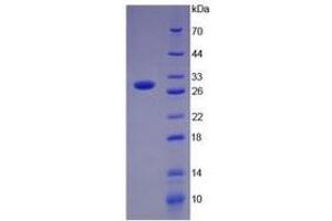 SDS-PAGE of Protein Standard from the Kit (Highly purified E. (PD-L1 Kit ELISA)
