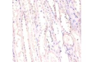 Immunohistochemistry of paraffin-embedded human kidney tissue using ABIN7168366 at dilution of 1:100 (FUS anticorps  (AA 1-198))