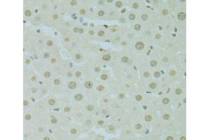 Immunohistochemistry of paraffin-embedded Rat liver using SAFB Polyclonal Antibody at dilution of 1:100 (40x lens).