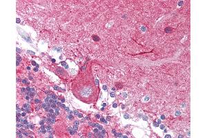 Anti-STMN1 antibody IHC of human brain, cerebellum. (Stathmin 1 anticorps  (Ser37))