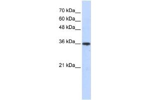 WB Suggested Anti-AKR7A3 Antibody Titration: 0. (AKR7A3 anticorps  (Middle Region))