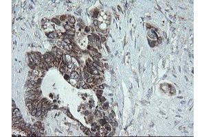 Image no. 5 for anti-NADH Dehydrogenase (Ubiquinone) 1 beta Subcomplex, 10, 22kDa (NDUFB10) antibody (ABIN1499668)