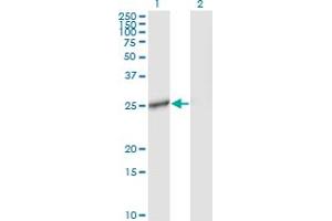 Western Blot analysis of IL27 expression in transfected 293T cell line by IL27 monoclonal antibody (M01), clone 3F12. (IL-27 anticorps  (AA 177-243))