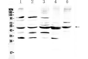 Western blot analysis of Bag5 using anti- Bag5 antibody .
