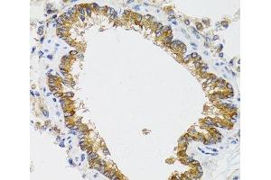 Immunohistochemistry of paraffin-embedded Rat lung using CHMP4B Polyclonal Antibody at dilution of 1:100 (40x lens). (CHMP4B anticorps)