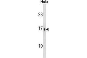 UBE2D3 Antibody (C-term) western blot analysis in Hela cell line lysates (35 µg/lane).