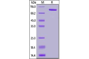Human FAP, His Tag (MALS verified) on  under reducing (R) condition.