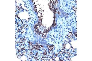 Immunohistochemistry of paraffin-embedded rat lung using MUC1 Rabbit pAb (ABIN6131522, ABIN6144194, ABIN6144195 and ABIN6213810) at dilution of 1:100 (40x lens). (MUC1 anticorps  (AA 1182-1255))