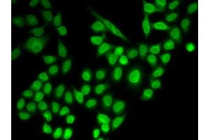 Immunofluorescence analysis of MCF-7 cells using RANGAP1 antibody (ABIN6290858). (RANGAP1 anticorps)