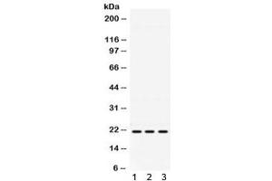 Western blot testing of 1) mouse brain, 2) human HeLa and 3) human A549 lysate with HRAS antibody. (HRAS anticorps)