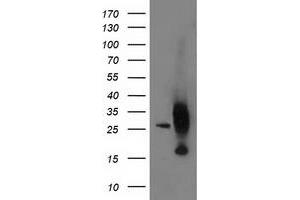Western Blotting (WB) image for anti-Adenylate Kinase 4 (AK4) antibody (ABIN1496530) (AK4 anticorps)