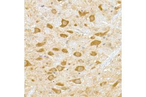 Immunohistochemistry of paraffin-embedded mouse brain using DENN Rabbit mAb (ABIN7268396) at dilution of 1:50 (40x lens). (MADD anticorps)