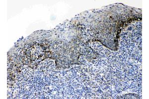 IHC analysis of CD166/ALCAM using anti- CD166/ALCAM antibody .