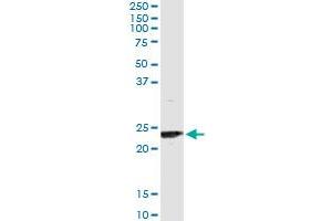 Immunoprecipitation of UBE2T transfected lysate using anti-UBE2T monoclonal antibody and Protein A Magnetic Bead , and immunoblotted with UBE2T MaxPab rabbit polyclonal antibody. (Ube2t anticorps  (AA 1-197))
