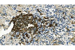 IHC analysis of CD20/MS4A1 using anti-CD20/MS4A1 antibody (ABIN7599233). (CD20 anticorps  (AA 1-297))