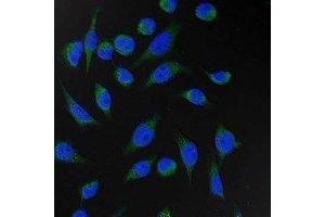Immunofluorescent analysis of Fumarase staining in Hela cells.