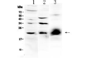 Western blot analysis of IL-22 using anti-IL-22 antibody . (IL-22 anticorps  (AA 34-179))