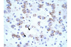 CATSPER2 antibody was used for immunohistochemistry at a concentration of 4-8 ug/ml to stain Neural cells (arrows) in Human Brain. (CATSPER2 anticorps  (N-Term))