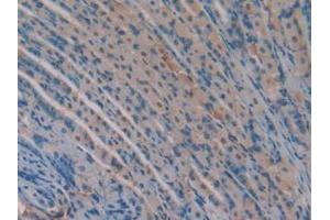IHC-P analysis of Mouse Stomach Tissue, with DAB staining. (Versican anticorps  (AA 3058-3299))