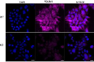 Immunocytochemical staining of HeLa cells using PDLIM1 antibody (ABIN7799748), 1:1,000), Top panel: wild-type (WT), Bottom panal: PDLIM1 shRNA knockdown (KD). (Recombinant PDLIM1 anticorps)