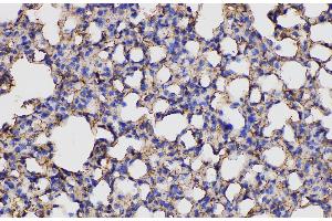 Immunohistochemistry of paraffin-embedded Mouse lung using ANXA5 Polycloanl Antibody at dilution of 1:150