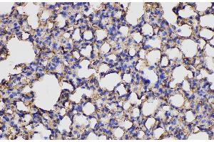 Immunohistochemistry of paraffin-embedded Mouse lung using ANXA5 Polycloanl Antibody at dilution of 1:150 (Annexin V anticorps)