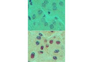 Image no. 1 for anti-One Cut Homeobox 1 (ONECUT1) (AA 420-470) antibody (ABIN960298) (ONECUT1 anticorps  (AA 420-470))