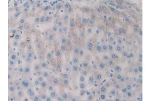 Used in DAB staining on fromalin fixed paraffin- embedded kidney tissue (FLT1 anticorps  (AA 303-524))