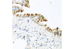 Immunohistochemistry of paraffin-embedded mouse lung using BMP4 antibody at dilution of 1:100 (40x lens). (BMP4 anticorps)