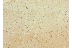 Immunohistochemistry of paraffin-embedded human heart tissue using ABIN7163876 at dilution of 1:100