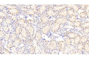 Detection of NFE2L2 in Rat Kidney Tissue using Polyclonal Antibody to Nuclear Factor, Erythroid Derived 2 Like Protein 2 (NFE2L2)