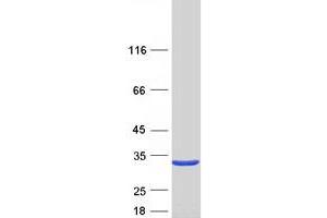 Validation with Western Blot