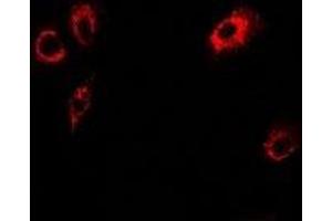 Immunofluorescent analysis of Tropomodulin-4 staining in U2OS cells. (Tropomodulin 4 anticorps)