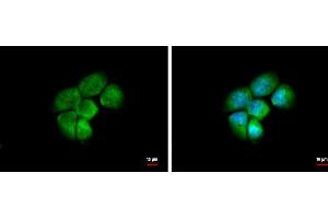 ICC/IF Image HSD3a antibody [N1C2] detects HSD3a protein at cytoplasm and nucleus by immunofluorescent analysis. (AKR1C4 anticorps)