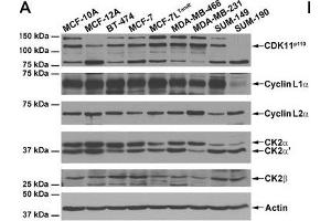 Expression of CDK11 and CK2 protein complex members in untransformed and malignant breast cells.