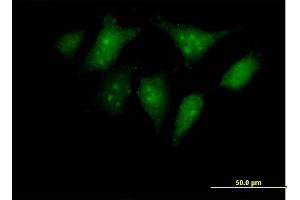 Immunofluorescence of purified MaxPab antibody to RBED1 on HeLa cell. (ELMOD3 anticorps  (AA 1-391))