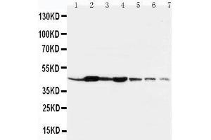 Lane 1: Rat Liver Tissue LysateLane 2: Rat Spleen Tissue LysateLane 3: Rat Brain Tissue LysateLane 4: Rat Kidney Tissue LysateLane 5: HELA Cell LysateLane 6: SMMC Cell LysateLane 7: SGC Cell Lysate (beta Actin anticorps  (N-Term))