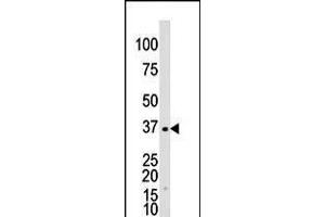 Antibody is used in Western blot to detect GALK1 in Y79 cell lysate.